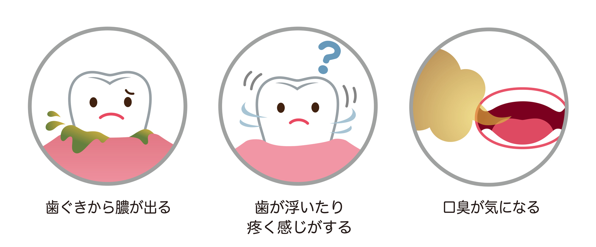 虫歯の症状